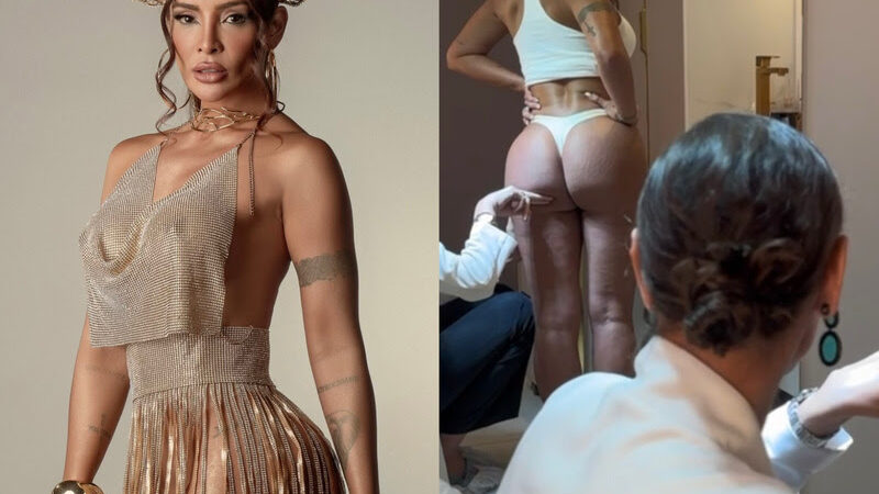 Carol Nakamura aposta em tratamento antes do Carnaval 2026