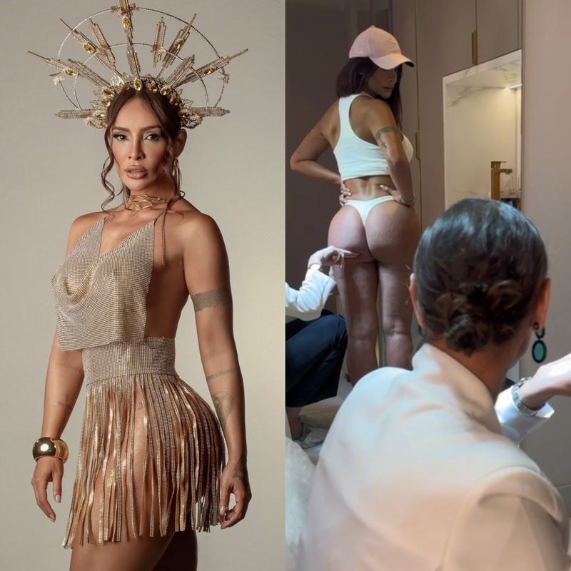 Carol Nakamura aposta em tratamento antes do Carnaval 2026