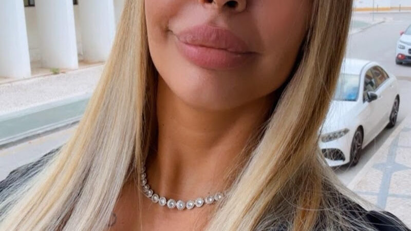 Influenciadora se afasta das redes após diagnóstico por filtros