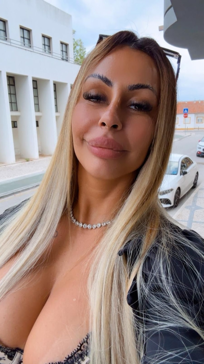 Influenciadora se afasta das redes após diagnóstico por filtros